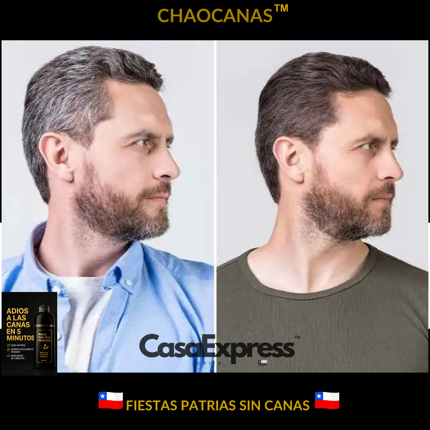 Shampoo ChaoCanas 3 En 1 - 400ml