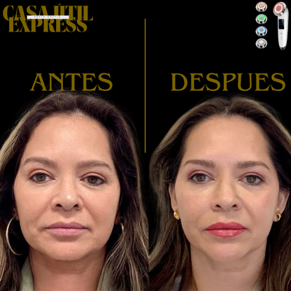 NeoLift 5  Anti-edad (Efecto Lifting) + Gratis Serum 24K
